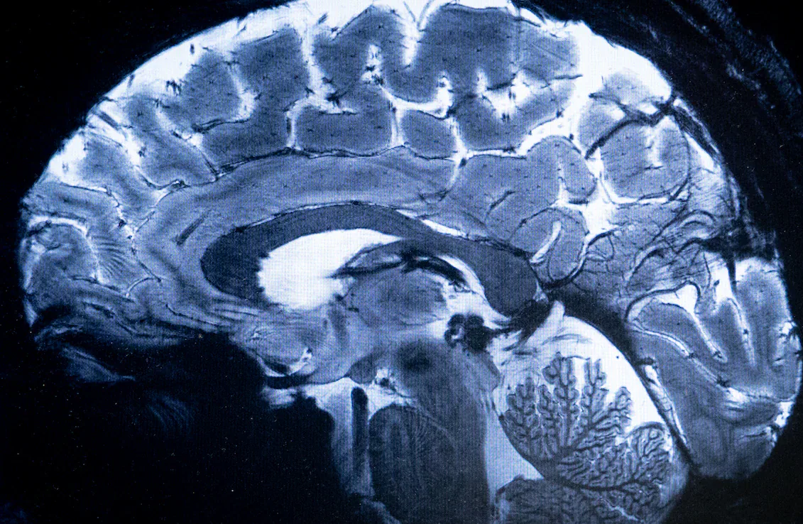 दुनिया की सबसे शक्तिशाली एमआरआई ने मानव मस्तिष्क की पहली छवि स्कैन की